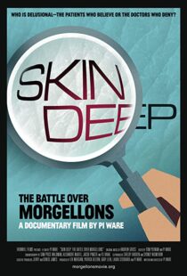 دانلود مستند Skin Deep: The Battle Over Morgellons 2019104233-142805632